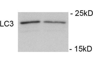 Image no. 5 for anti-Microtubule-Associated Protein 1 Light Chain 3 alpha (MAP1LC3A) (AA 1-30), (N-Term), (pSer12) antibody (ABIN1449623)