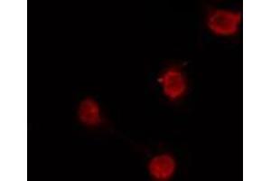 Image no. 2 for anti-SKI-Like Oncogene (SKIL) antibody (ABIN6258322)