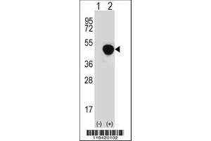 Image no. 1 for anti-Leucine-Rich alpha-2 Glycoprotein 1 (LRG1) (AA 86-114), (N-Term) antibody (ABIN652229)