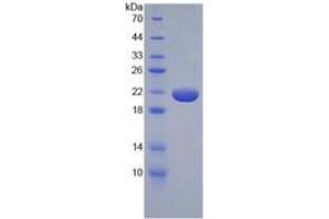 SDS-PAGE (SDS) image for Tumor Necrosis Factor alpha (TNF alpha) ELISA Kit (ABIN6574141)