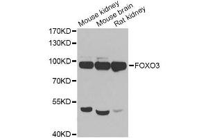 FOXO3 Antikörper  (AA 394-672)