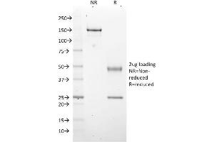 Image no. 3 for anti-Enhancer of Zeste Homolog 2 (EZH2) antibody (ABIN6939360)