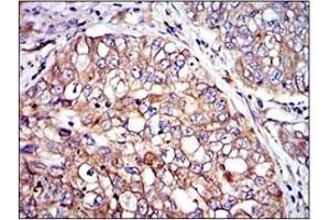 Image no. 1 for anti-V-Crk Sarcoma Virus CT10 Oncogene Homolog (Avian) (CRK) antibody (ABIN1106835)
