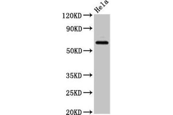 SLC22A25 anticorps  (AA 31-145)