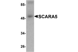 Image no. 2 for anti-Scavenger Receptor Class A, Member 5 (SCARA5) (C-Term) antibody (ABIN1030645)