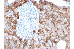 Image no. 5 for anti-Tumor-Associated Calcium Signal Transducer 2 (TACSTD2) (AA 31-274) antibody (ABIN6939972)