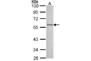WB Image Sample (30 ug of whole cell lysate) A: A431 , 10% SDS PAGE antibody diluted at 1:3000