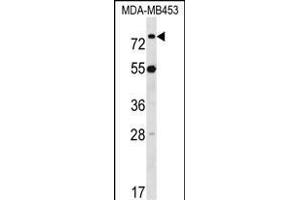 LDB3 Antibody (Center) (ABIN1538145 and ABIN2848672) western blot analysis in MDA-M cell line lysates (35 μg/lane).