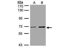 Image no. 1 for anti-Chromodomain Protein, Y-Like (CDYL) (C-Term) antibody (ABIN2854560)