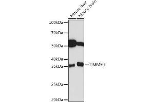Western blot analysis of extracts of various cell lines, using TIMM50 Rabbit mAb (ABIN1513120, ABIN3022092, ABIN3022093 and ABIN7101443) at 1:1000 dilution.