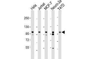 Image no. 6 for anti-Enhancer of Zeste Homolog 2 (EZH2) (AA 1-296), (N-Term) antibody (ABIN650707)