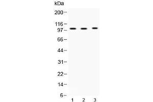 Image no. 1 for anti-ADAM Metallopeptidase Domain 2 (ADAM2) (AA 231-274) antibody (ABIN5647674)