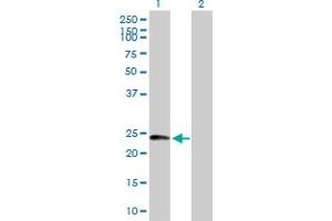 Western Blot analysis of DCTN6 expression in transfected 293T cell line by DCTN6 MaxPab polyclonal antibody.
