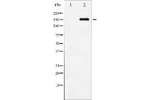 Image no. 3 for anti-Mitogen-Activated Protein Kinase Kinase Kinase 5 (MAP3K5) (pSer83) antibody (ABIN6256431)