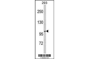 Western Blotting (WB) image for anti-CTD (Carboxy-terminal Domain, RNA Polymerase II, Polypeptide A) Phosphatase, Subunit 1 (CTDP1) antibody (ABIN2158390)