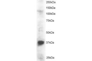 Image no. 1 for anti-PIN2/TERF1 Interacting, Telomerase Inhibitor 1 (PINX1) (N-Term) antibody (ABIN184695)