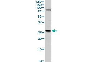 Image no. 2 for anti-TGFB-Induced Factor Homeobox 2 (TGIF2) (AA 131-236) antibody (ABIN566207)