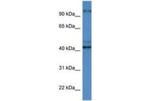 Image no. 1 for anti-Ataxia, Cerebellar, Cayman Type (ATCAY) (C-Term) antibody (ABIN6746922)