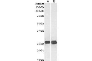 Image no. 1 for anti-Synaptosomal-Associated Protein, 25kDa (SNAP25) (C-Term) antibody (ABIN185392)