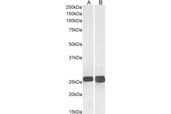 SNAP25 anticorps  (C-Term)