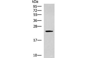 Western blot analysis of Human fetal liver tissue lysate using CMPK1 Polyclonal Antibody at dilution of 1:700