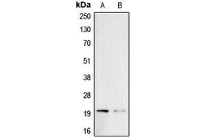 Image no. 1 for anti-Betacellulin (BTC) (Center) antibody (ABIN2706870)