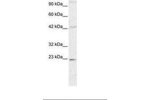 Image no. 2 for anti-High Mobility Group Box 2 (HMGB2) (C-Term) antibody (ABIN6735776)