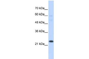 Image no. 1 for anti-TAF12 RNA Polymerase II, TATA Box Binding Protein (TBP)-Associated Factor, 20kDa (TAF12) (N-Term) antibody (ABIN2792680)