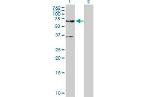 Image no. 1 for anti-ER Degradation Enhancer, Mannosidase alpha-Like 2 (EDEM2) (AA 1-578) antibody (ABIN527637)
