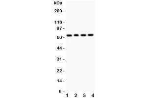 Western blot testing of FOXO1 antibody and Lane 1:  rat lung;  2: (r) brain;  3: human COLO320;  4: (h) HEPG2.