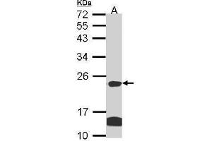 WB Image Sample (30 ug of whole cell lysate) A: Hela B: Hep G2 , 12% SDS PAGE antibody diluted at 1:1000