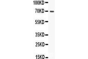 anti-Heparan Sulfate Proteoglycan 2 (HSPG2) (AA 524-701) antibody