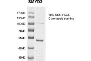 Image no. 1 for SET and MYND Domain Containing 3 (SMYD3) protein (DYKDDDDK Tag) (ABIN2669668)