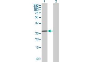 anti-Tetratricopeptide Repeat Domain 33 (TTC33) (AA 1-262) antibody