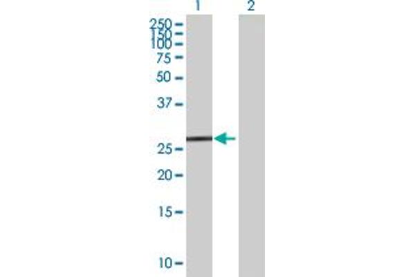 anti-Tetratricopeptide Repeat Domain 33 (TTC33) (AA 1-262) antibody