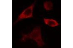 Image no. 1 for anti-Phospholipase D4 (PLD4) (C-Term) antibody (ABIN6259472)