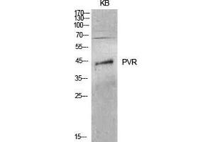 Image no. 2 for anti-Poliovirus Receptor (PVR) (Internal Region) antibody (ABIN3181466)