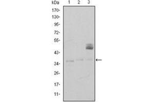 Image no. 5 for anti-CD1a (CD1a) antibody (ABIN1105998)