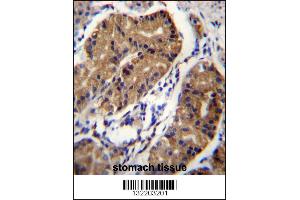 Immunohistochemistry (IHC) image for anti-Deleted in Colorectal Carcinoma (DCC) (Center) antibody (ABIN2160506)