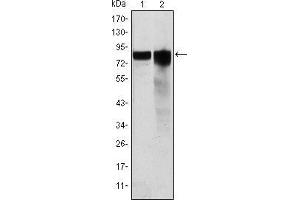 Image no. 3 for anti-Glycogen Synthase 1 (Muscle) (GYS1) antibody (ABIN969183)