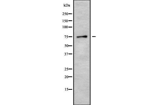 Calpain 6 antibody  (Internal Region)