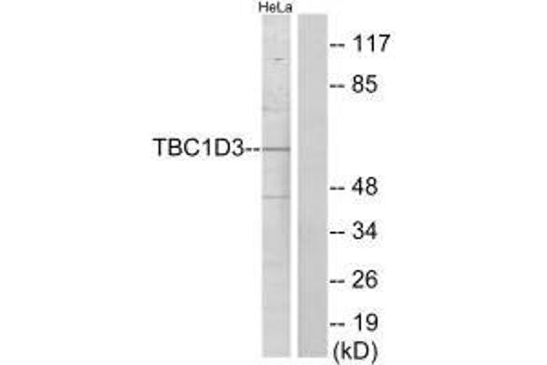 TBC1D3 抗体