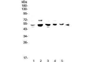 Image no. 1 for anti-Nuclear Factor I/B (NFIB) antibody (ABIN5708262)