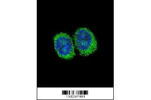 Image no. 3 for anti-Niemann-Pick Disease, Type C1 (NPC1) (AA 591-620) antibody (ABIN657395)