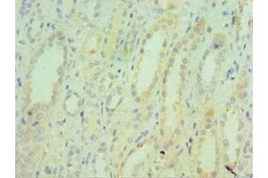 Immunohistochemistry of paraffin-embedded human kidney tissue using ABIN7171754 at dilution of 1:100