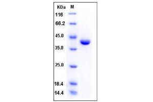 Image no. 1 for Pepsinogen C (PGC) (AA 1-388) protein (His tag) (ABIN2005020)