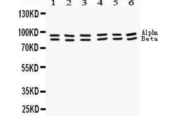 anti-Signal Transducer and Activator of Transcription 1, 91kDa (STAT1) (AA 114-143), (N-Term) antibody