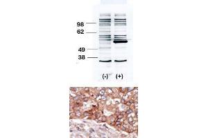 Image no. 2 for anti-B Lymphoid Tyrosine Kinase (BLK) (N-Term) antibody (ABIN359972)