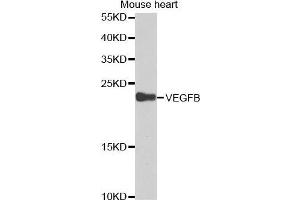 VEGFB 抗体  (AA 100-200)