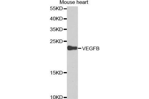 VEGFB anticorps  (AA 100-200)